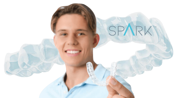 Spark aligners