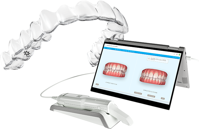 Invisalign treatment