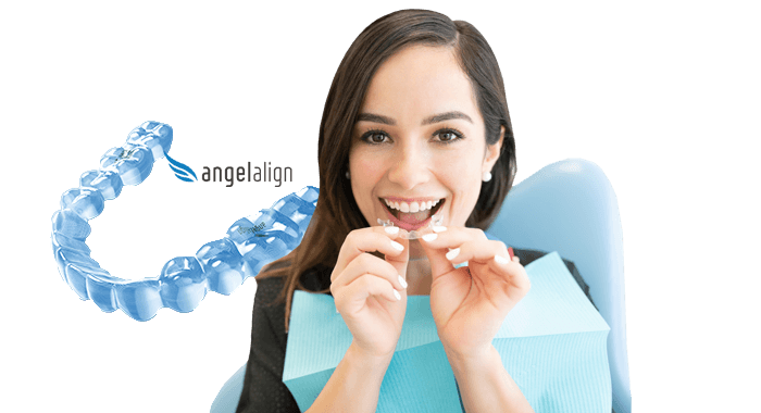 Angelalign clear aligners