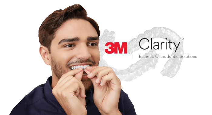 3m Clarity aligners